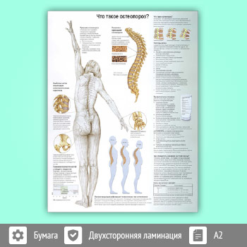 Плакат «Что такое остеопороз?» (ЗОЖ-02, 1 лист, A2)